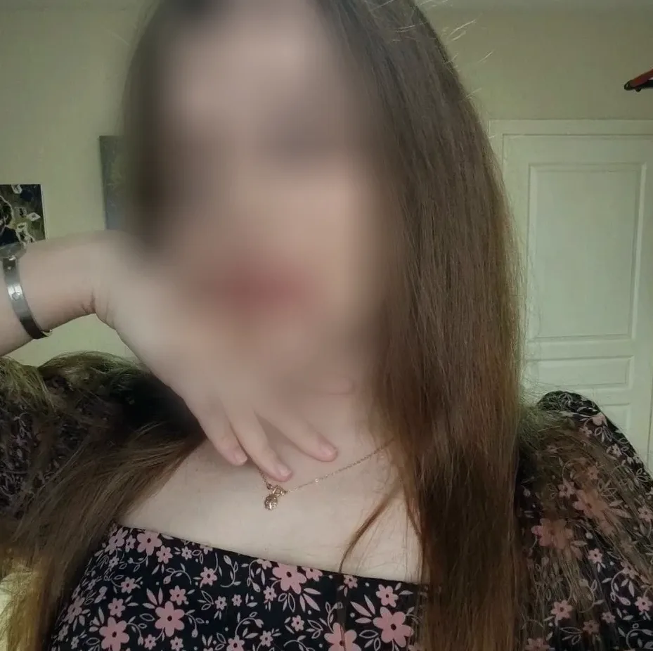 Skye, 24
